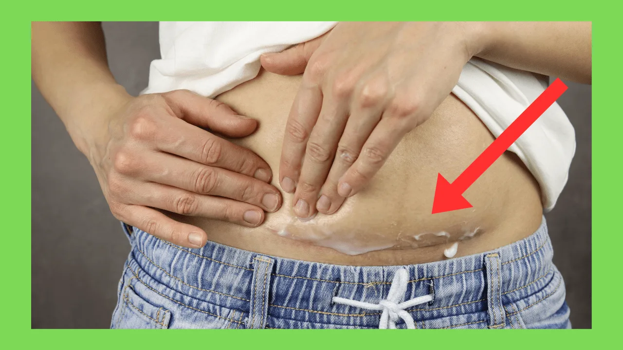 Caesarean Section
